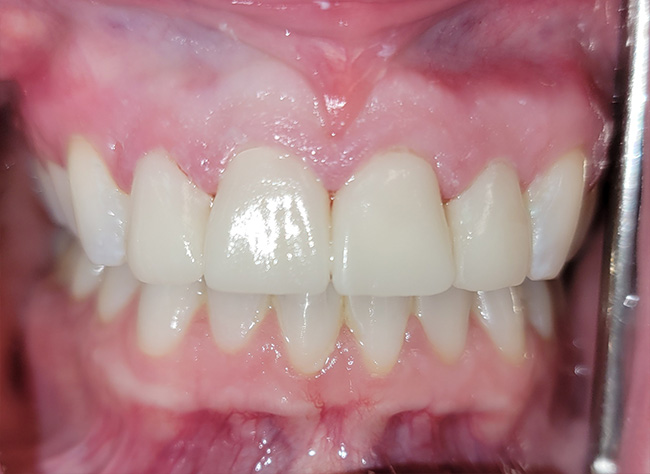 Diablo Valley Dental | Dental Bridges, Pediatric Dentistry and Dentures