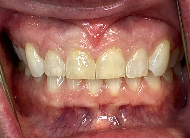 Diablo Valley Dental | Glidewell IO reg , Oral Exams and Dental Fillings