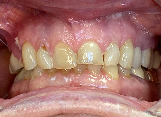 Diablo Valley Dental | Implant Dentistry, Sedation Dentistry and Extractions