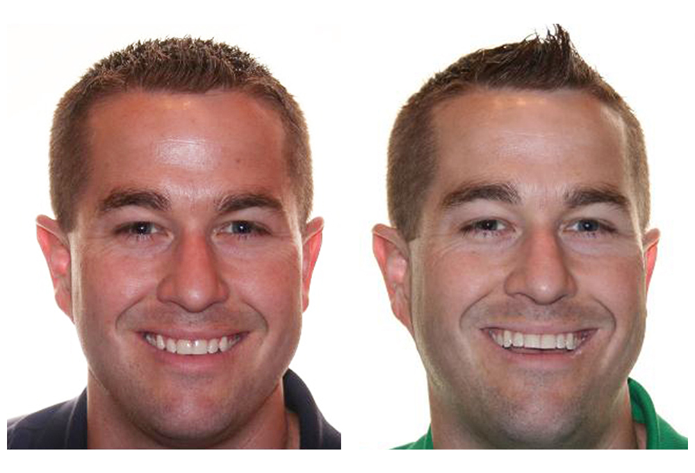 Diablo Valley Dental