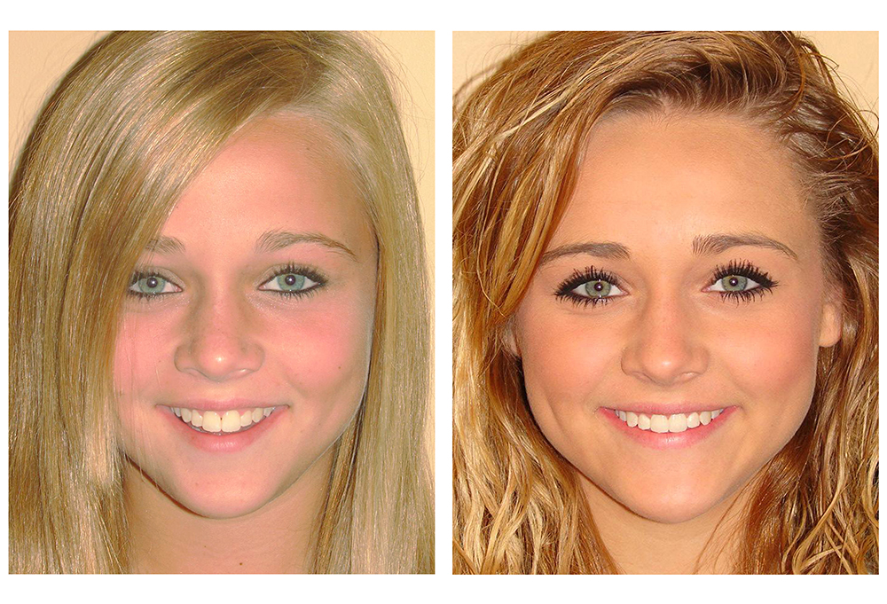 Diablo Valley Dental